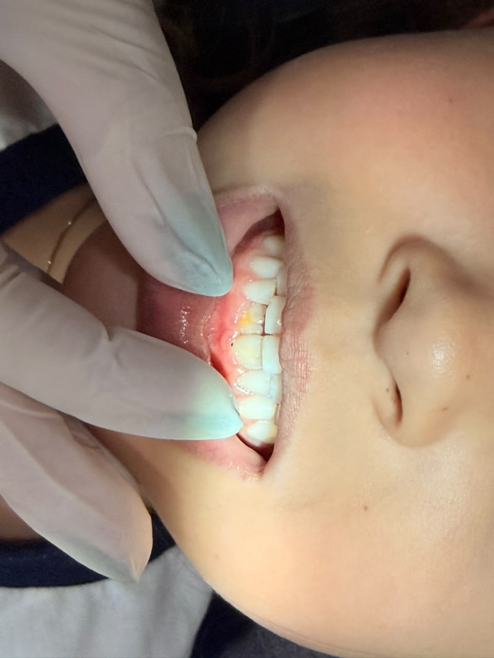 Registro clínico de atendimento odontológico 2